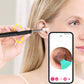 👂 50% RABATT! Visueller Ohrreiniger – mit Kamera, wechselbaren Silikonaufsätzen, wasserdicht – für eine sichere, hygienische Reinigung. 📱✅